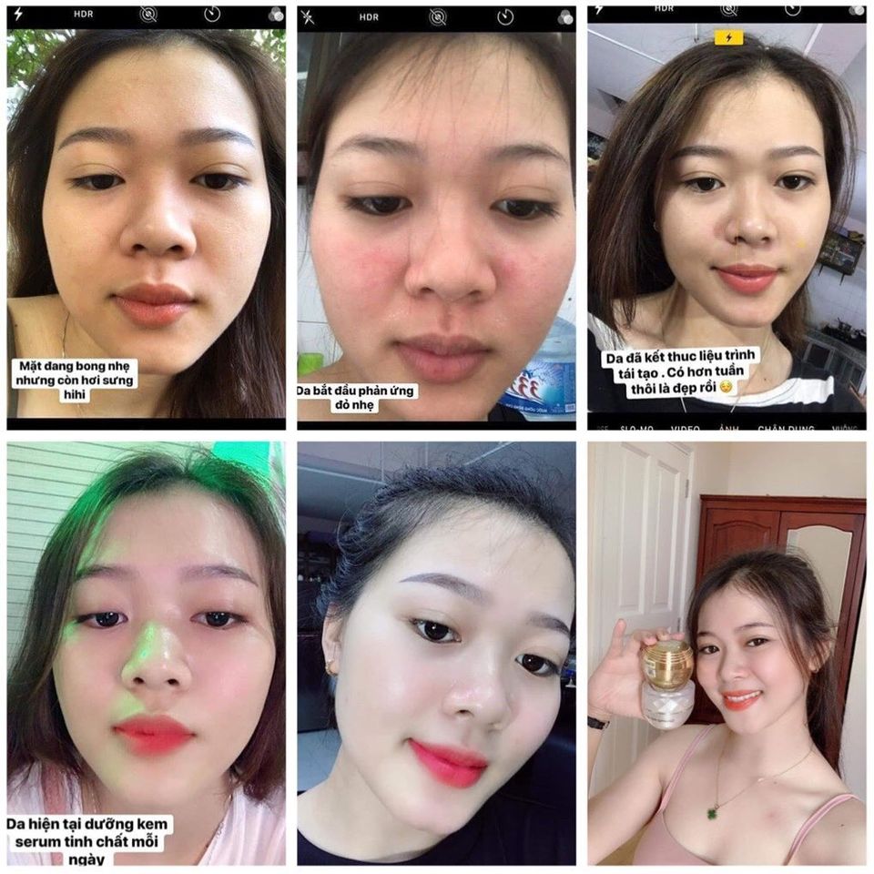 Kem tái tạo Chamomileskill